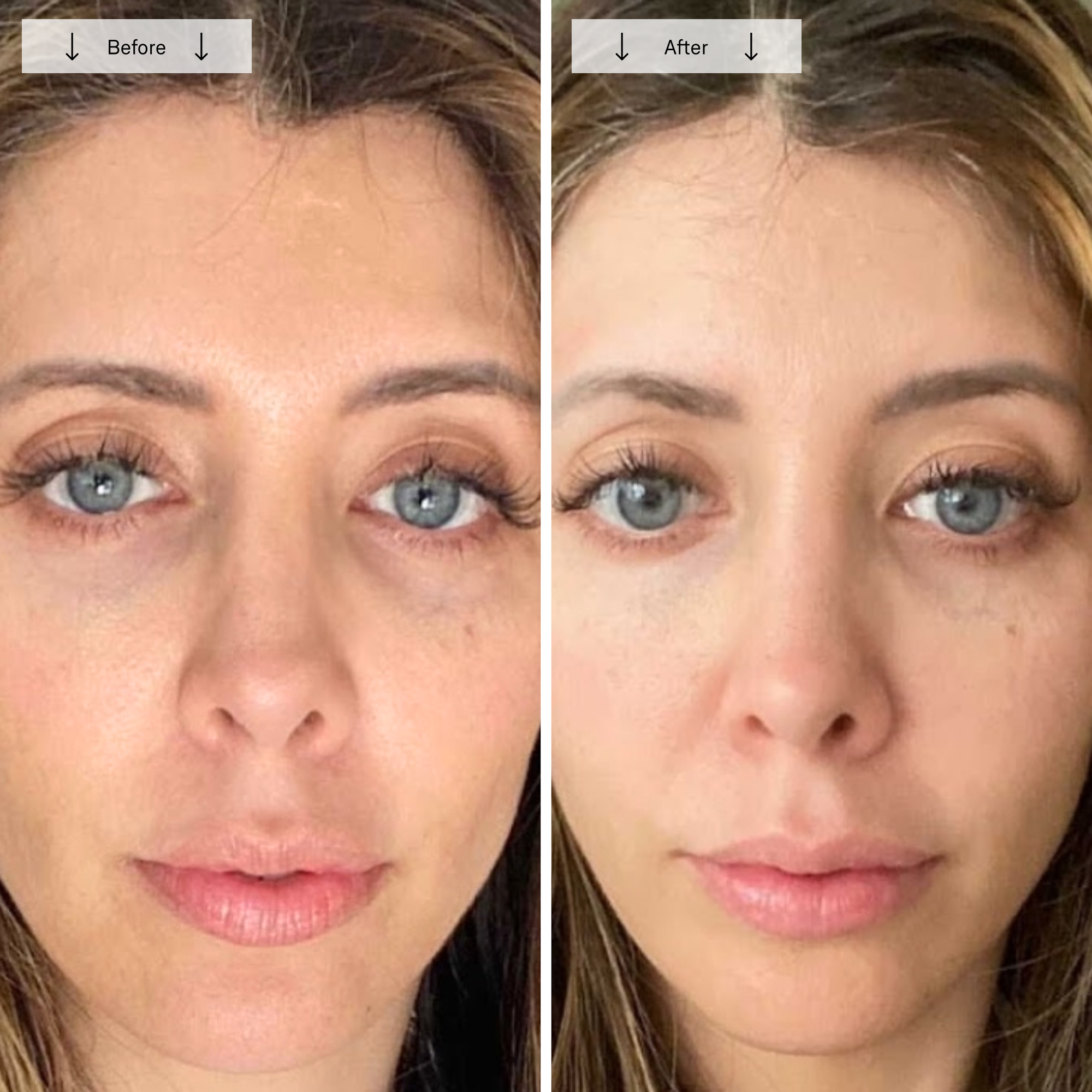 Omnilux Contour Face - Image 13